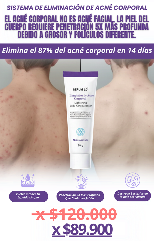 CREMA ANTI ACNE COORPORAL