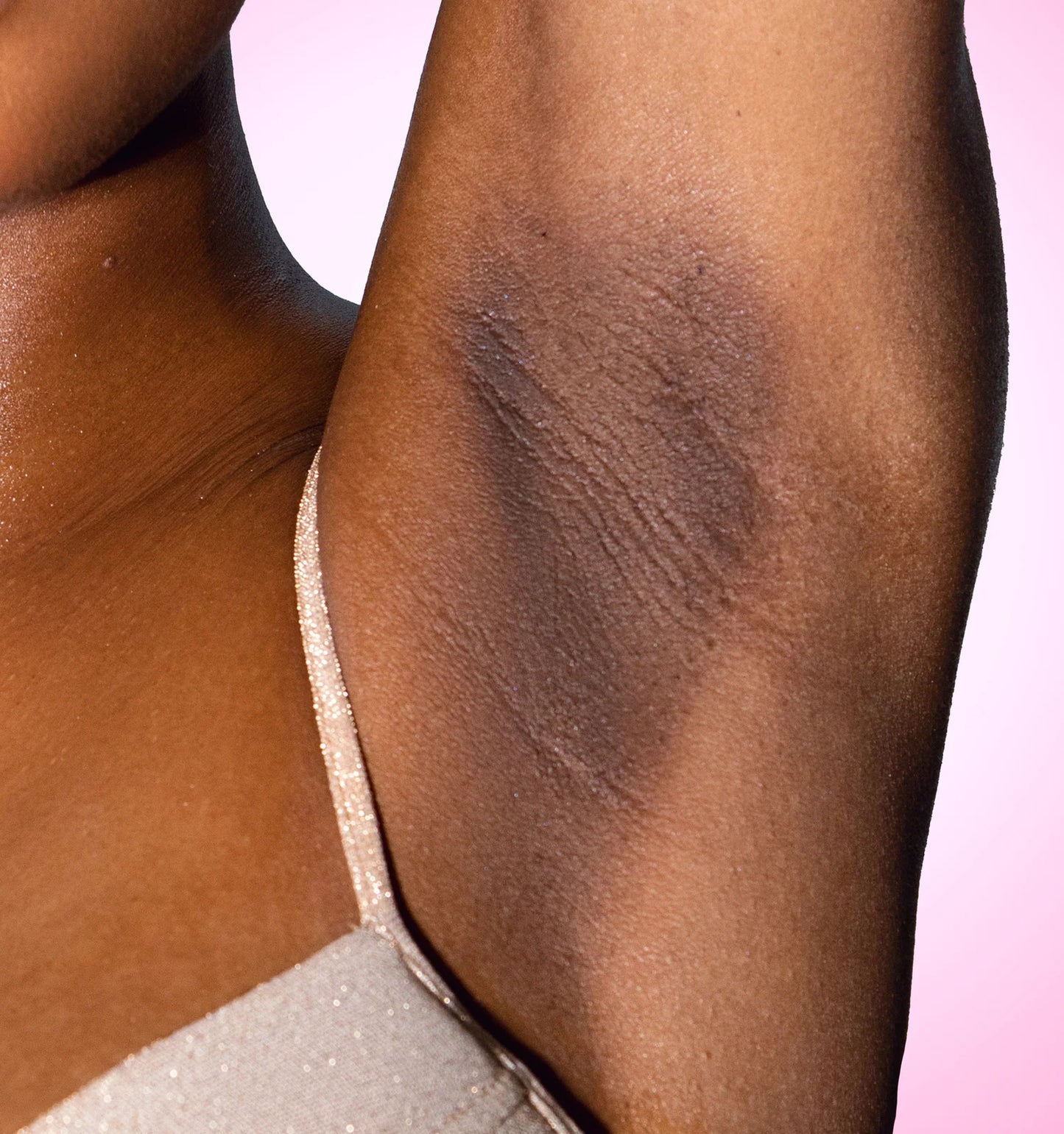 Serum The Ordinary - Elimina cualquier Hiperpegmentacion