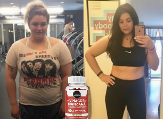 Gomitas de vinagre de Manzana | Logra tu peso ideal en 2026