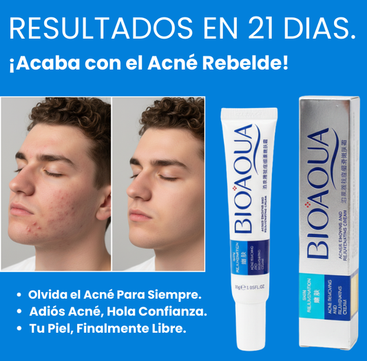 ClearSkin Crema Anti-Acné