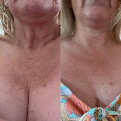 Gel rejuvenecedor Anti ojeras + Brocha