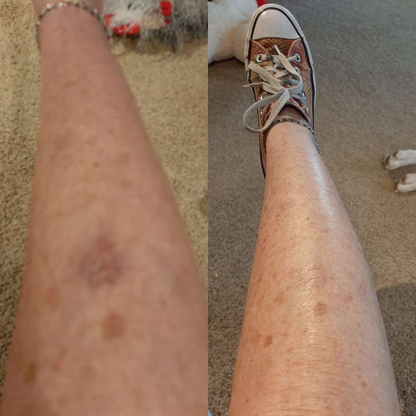 Gel rejuvenecedor Anti ojeras + Brocha