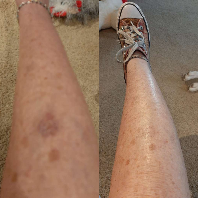 Peter Thomas Roth - Péptide TECH